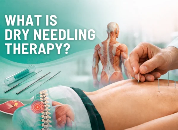 What is dry needling therapy What is dry needling