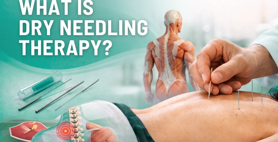 What is dry needling therapy What is dry needling