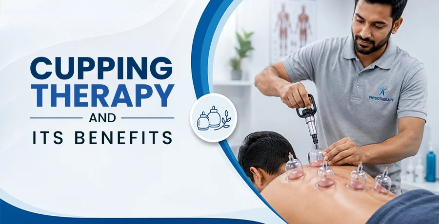 Cupping Therapy and Its Benefits Cupping Therapy