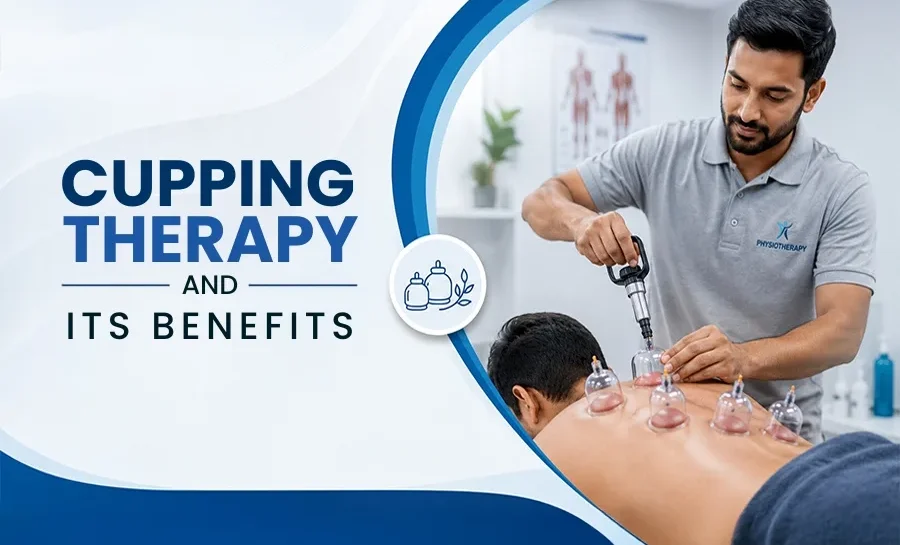 Cupping Therapy